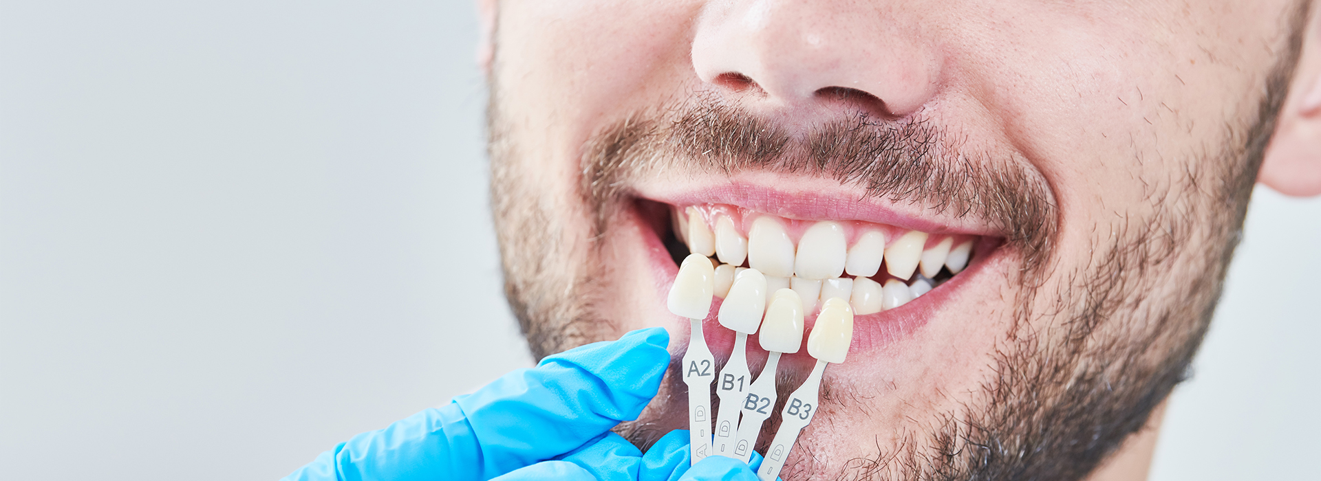 The image shows a man with a toothy smile, wearing a blue surgical mask and holding a dental implant between his teeth, while sitting in front of a computer monitor with a blurred background.